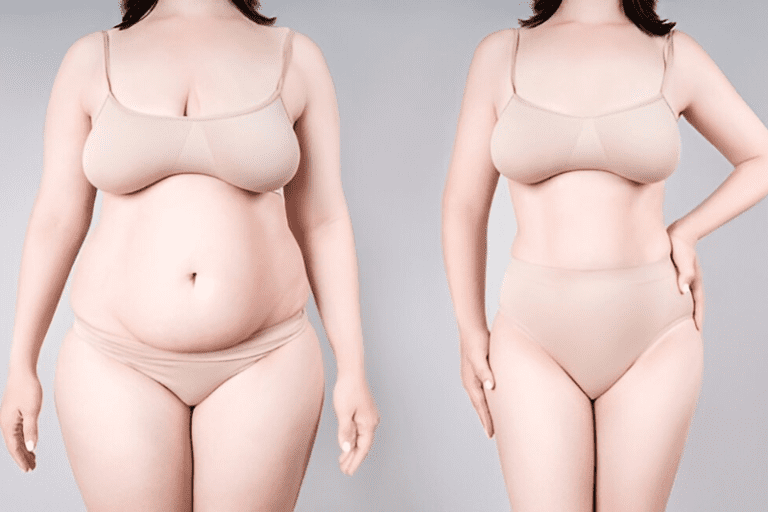 Vaser Lipo Tampa - Face, Chin, and Neck Fat Removal Procedure