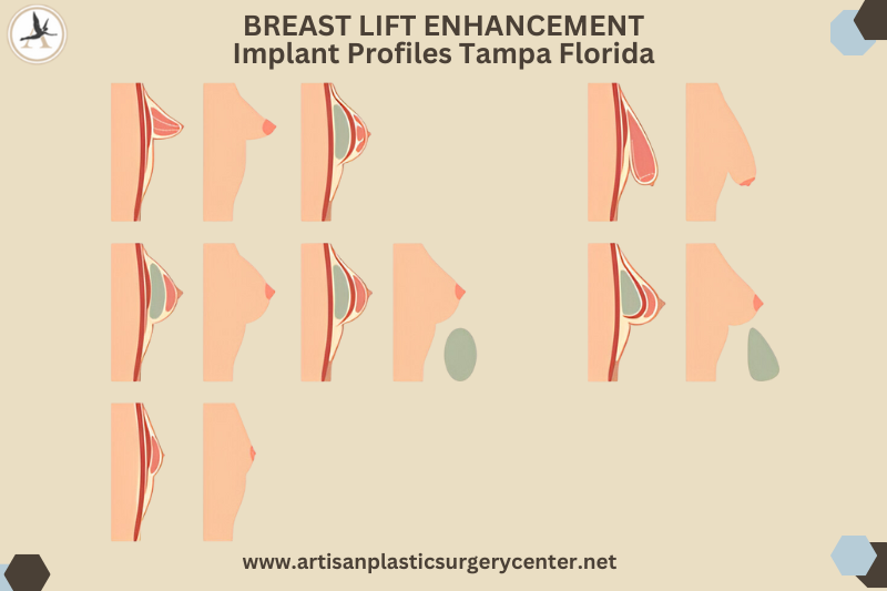Breast Lift Enhancement Implant Profiles Tampa Florida