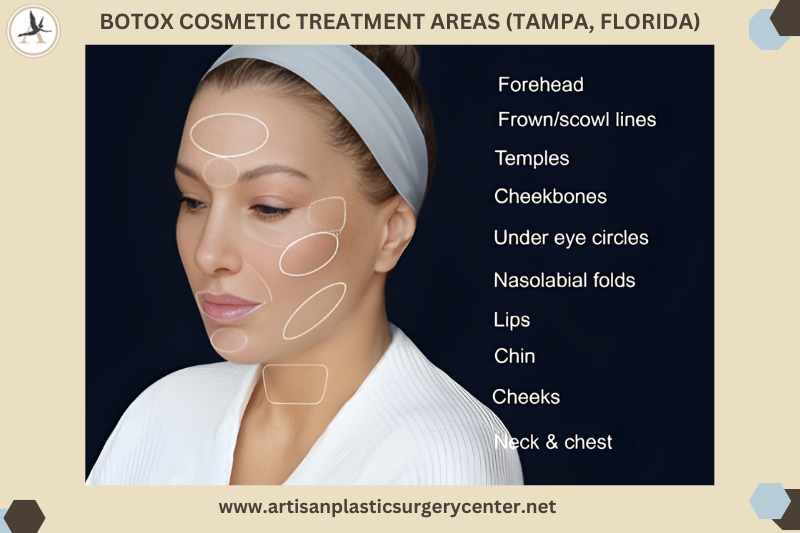 Botox Injectables Cosmetic Treatment Areas in Tampa Bay, Florida
