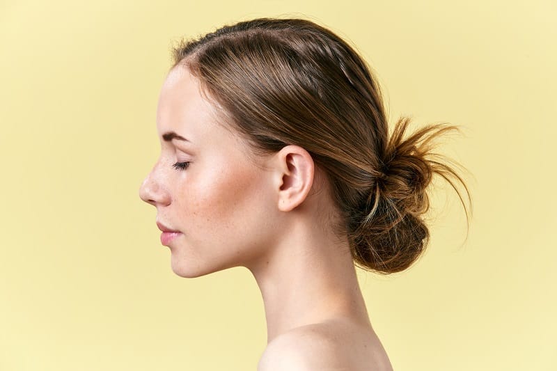 woman after rhinoplasty