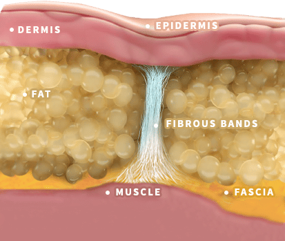 FatLayerDiagram