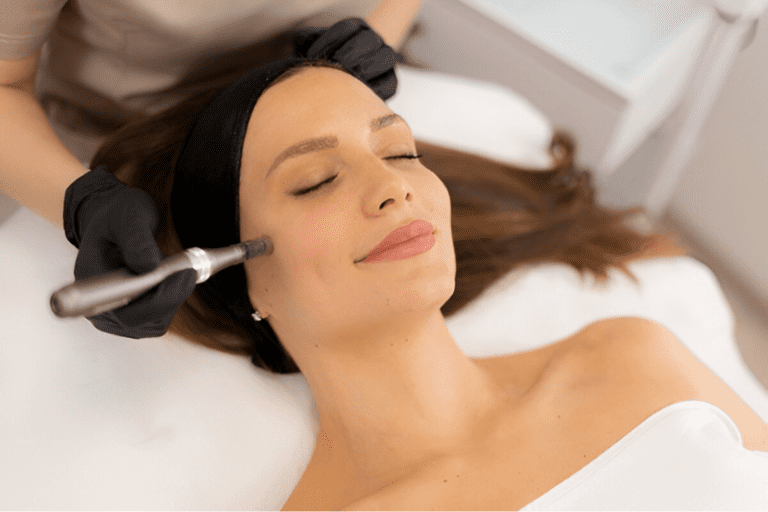 Skin Pen Microneedling Treatment - Benefits, Expectations, Results Guide Tampa, FL