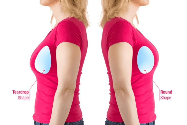 Right Breast Implant Size - Step by Step Measurement Guide