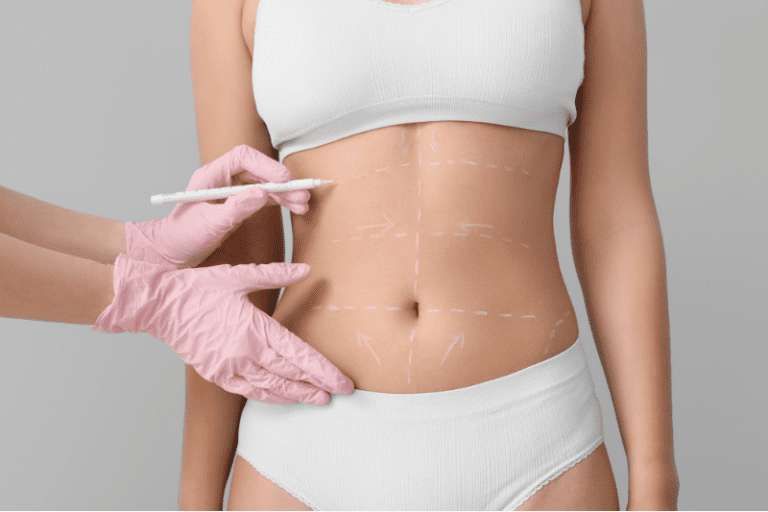 Which Type of Liposuction Is the Best for My Goals? Lipo Methods