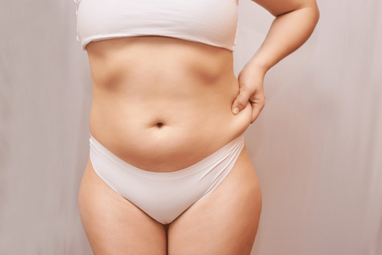 SmartLipo vs. Traditional Liposuction - Skin Tightening Recovery