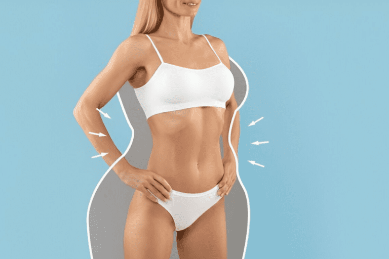 How Can You Maintain Your Liposuction Results? Recovery Guide