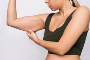 A woman in a black sports bra pulling on the loose skin on her upper arm.