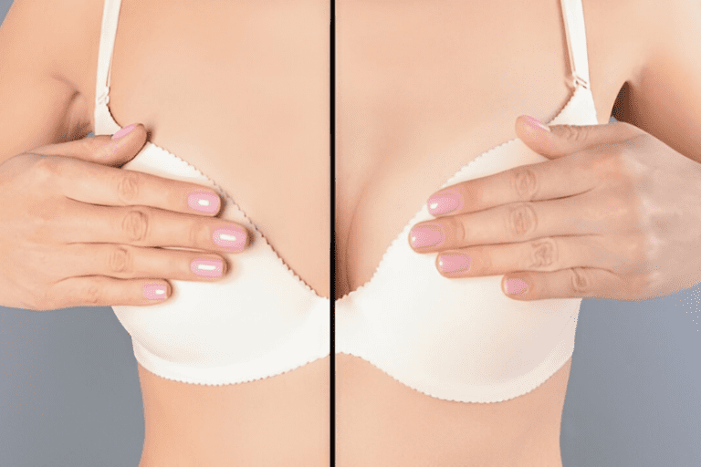 Breast Lift Recovery - Effective Pre and Post-Surgery Guide Tips