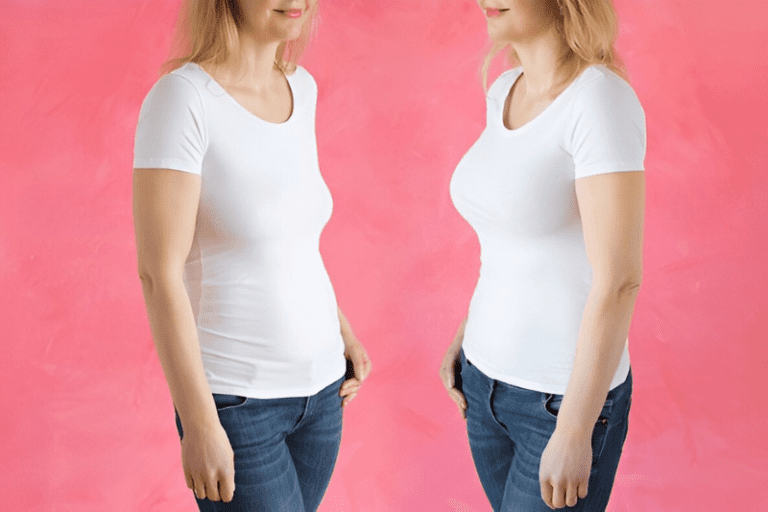 Breast Lift After Weight Loss - Benefits, Expectations, and Results in Tampa, FL