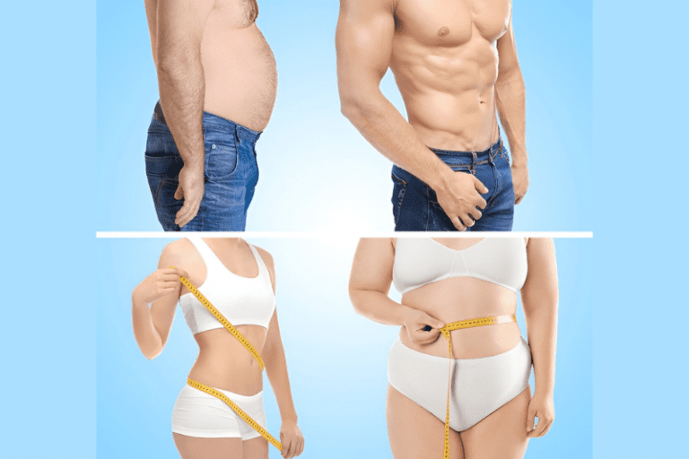 Liposuction for Men and Women - Significant Differences, Results