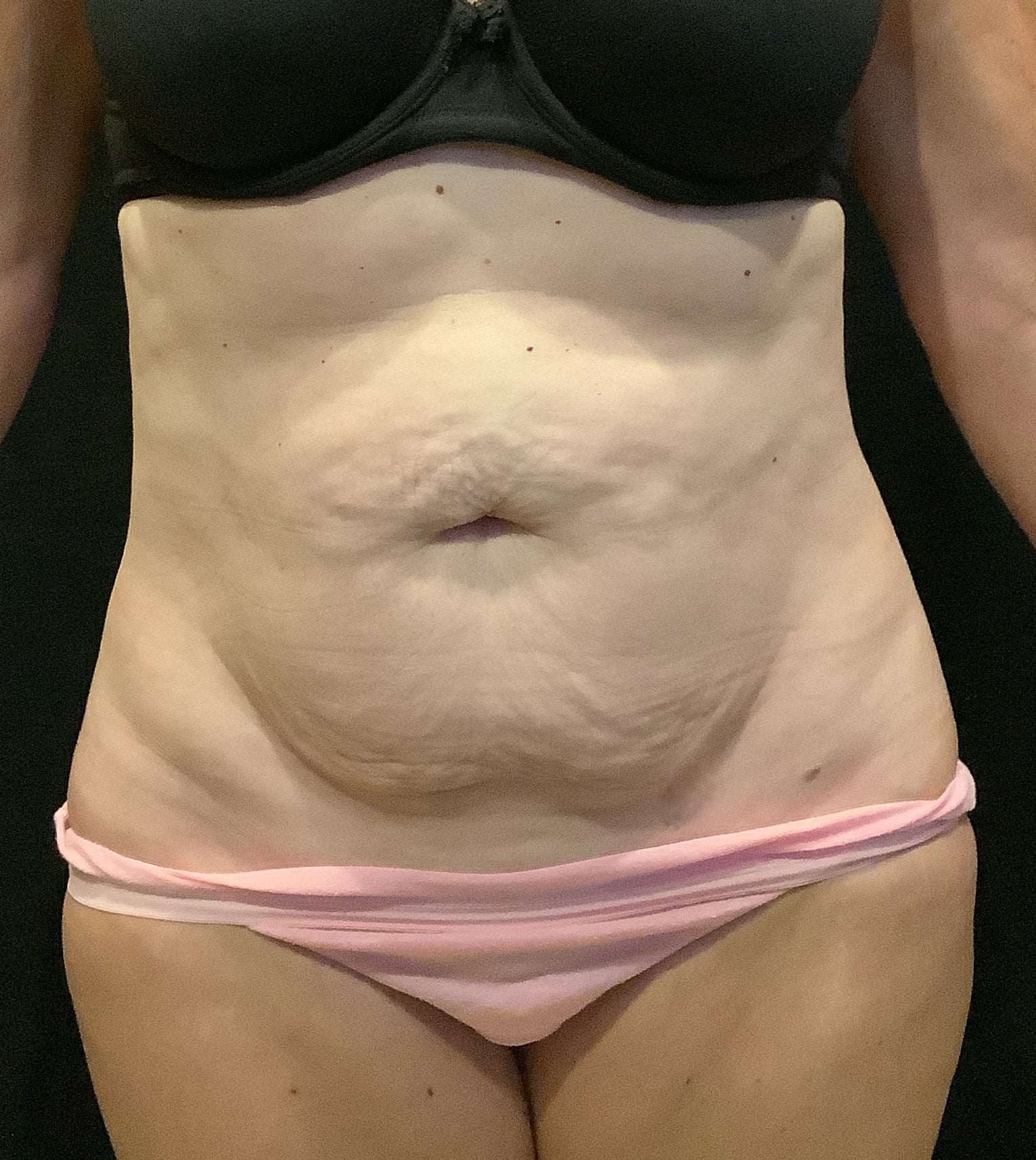 Before Image