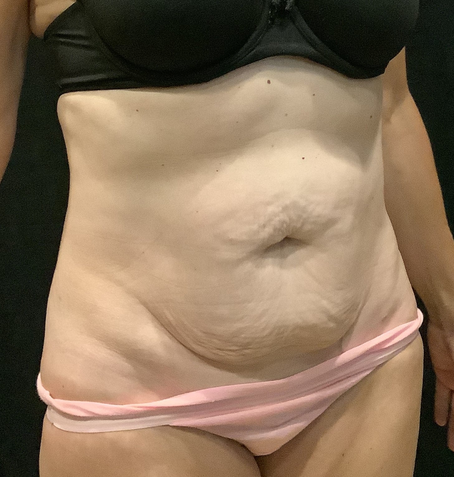 Before Image