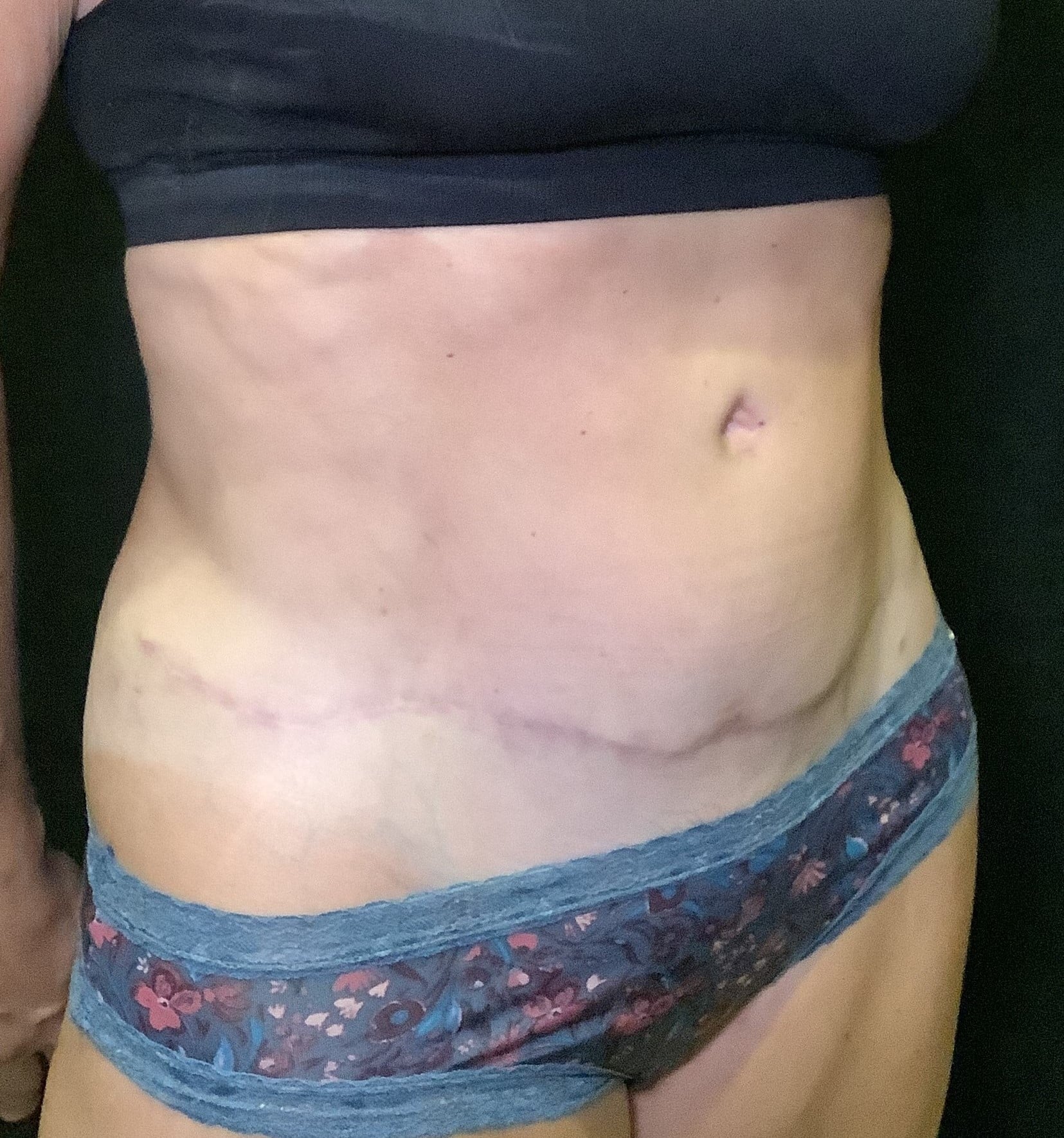 After Image