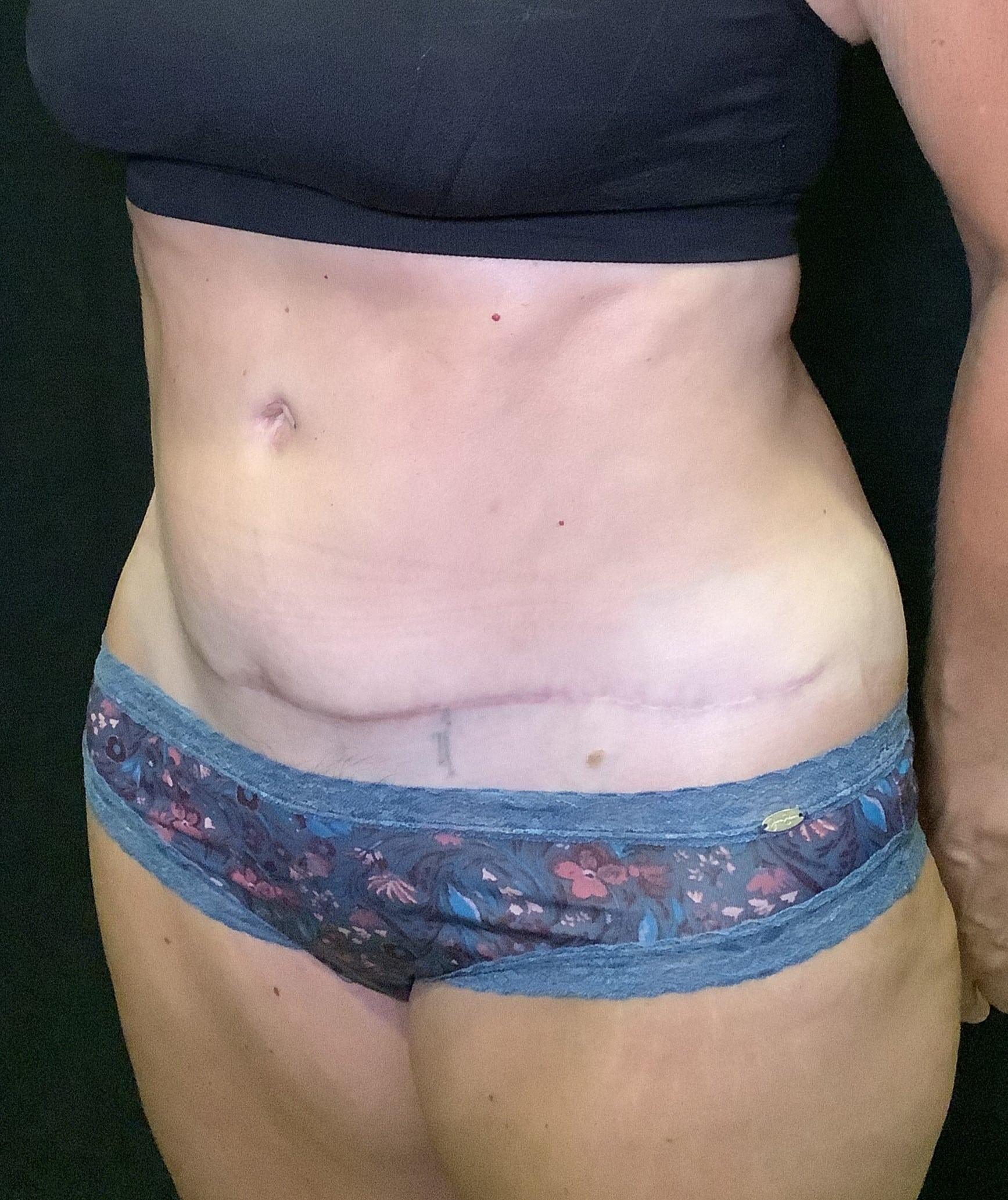 After Image