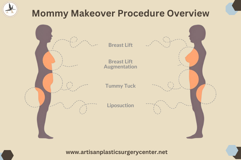 Mommy Makeover Procedure Overview Infographic