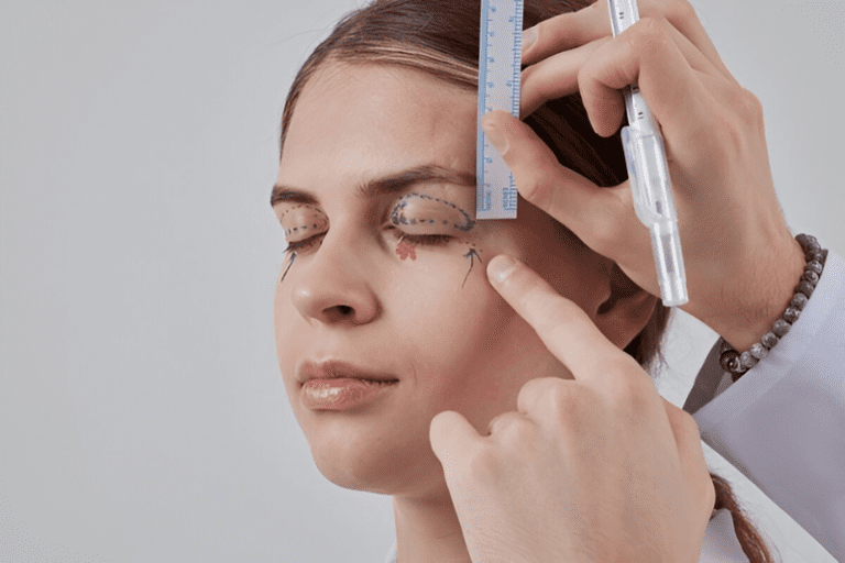 Will People Notice My Blepharoplasty Tips for Common Concerns