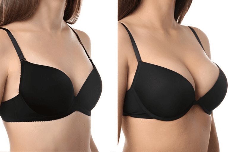 Breast Augmentation Procedure Tampa - Costs, Risks, Recovery