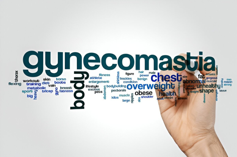 Male Breast Reduction Tampa - Gynecomastia Causes, Surgical and Non-Surgical Options, and Recovery Guide