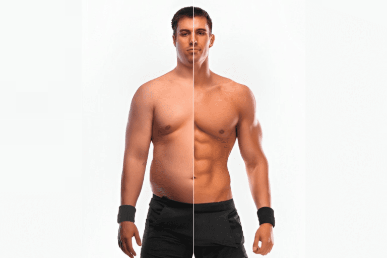 Male Breast Reduction Tampa - Gynecomastia Treatment Guide