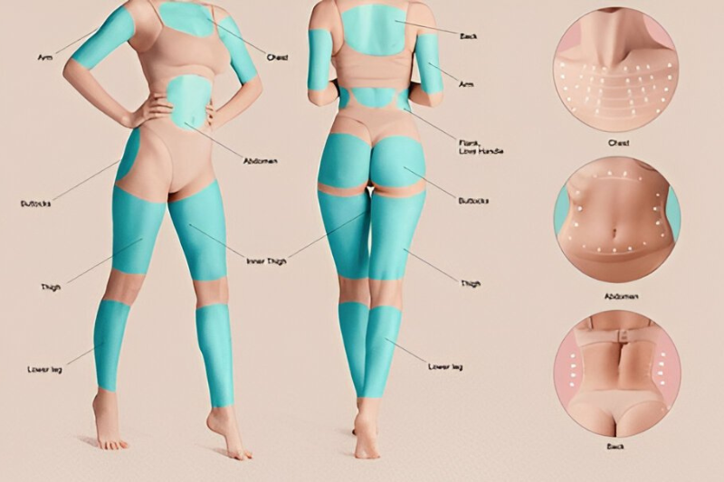 Vaser Liposuction Tampa - Precision Fat Removal Procedure 