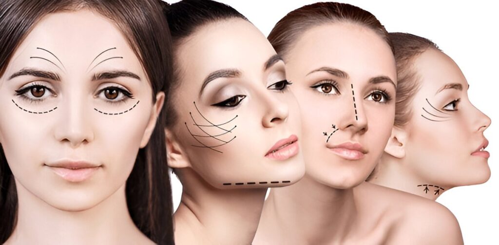 Facial Surgery_Patient Information - Access Plastic Surgery Patient Resources