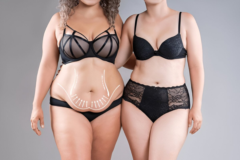 About Us - Artisan Aesthetics Plastic Surgery Tummy Tuck Tampa