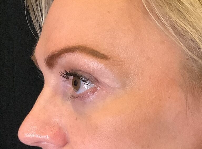 Facial Plastic Surgery Tampa