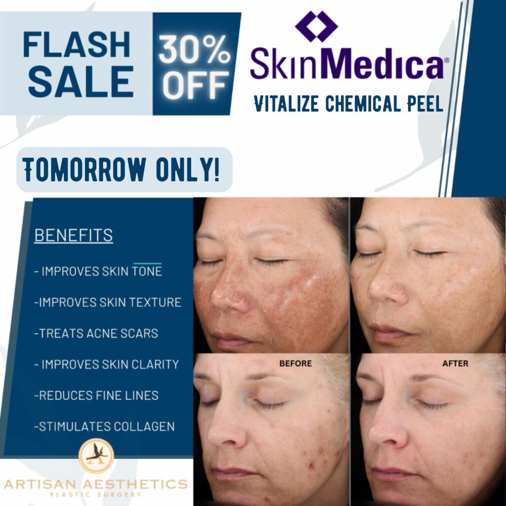Chemical Peels and Facials in Tampa - Reveal Smoother, Brighter Skin_SkinMedica® Vitalize Peel - FLASH SALE Treatment for Just $110