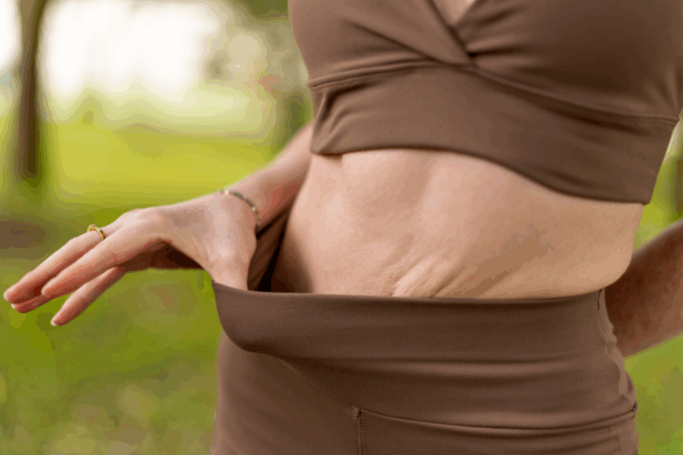 Ozempic Loose Skin Solutions Arms, Belly, Neck Options in Tampa