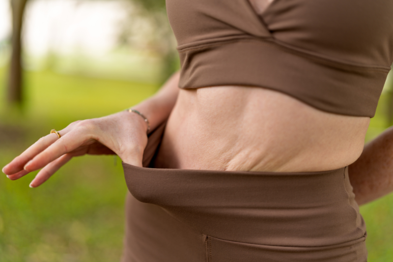 Ozempic Loose Skin Solutions Arms, Belly, Neck Options in Tampa