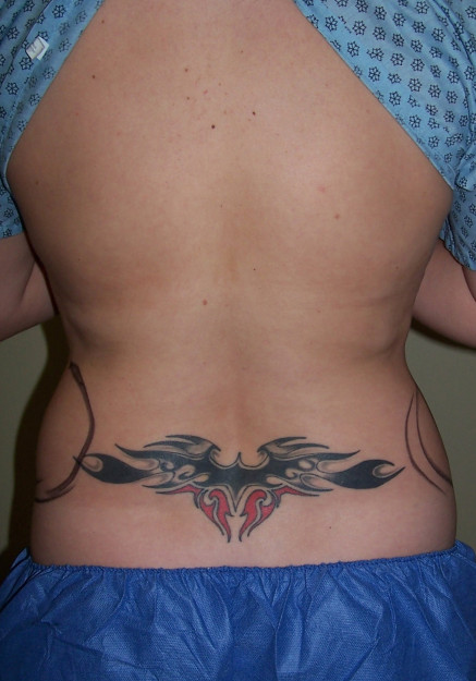 Before Image