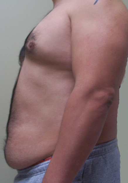 Before Image